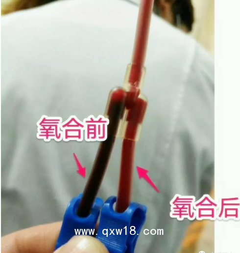 醫(yī)用臭氧治療儀國內