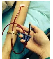 醫(yī)用臭氧治療儀大自血療法應用