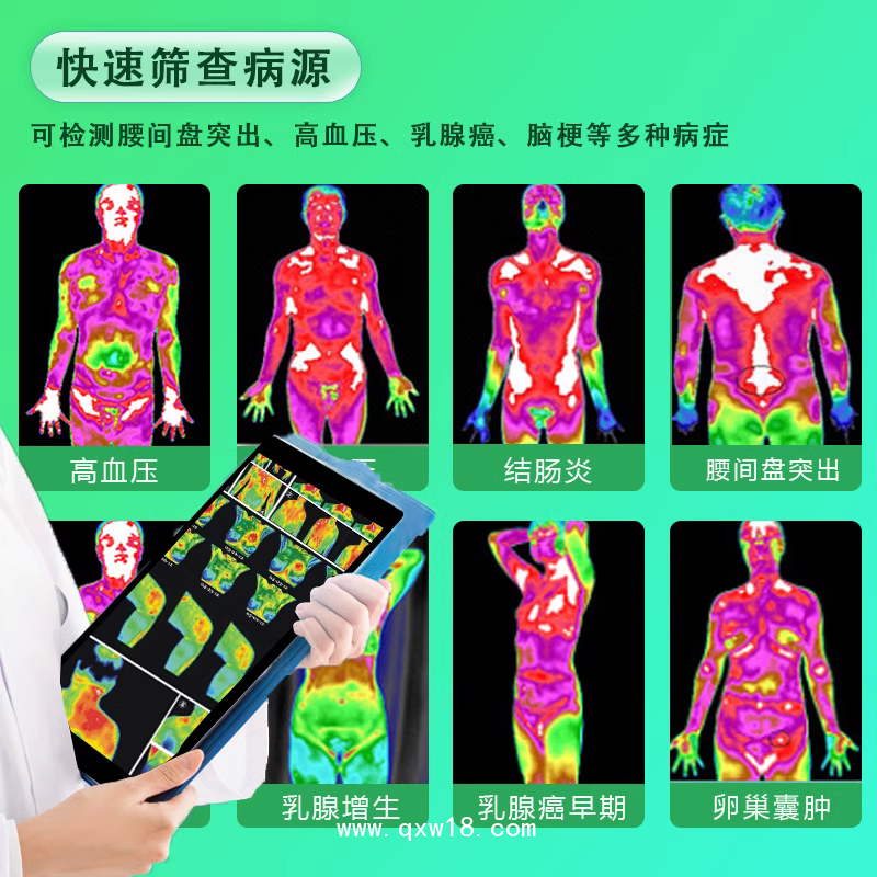 中醫(yī)熱ct體質(zhì)健康測試儀醫(yī)用紅外線成像儀透視機CT醫(yī)用成像儀