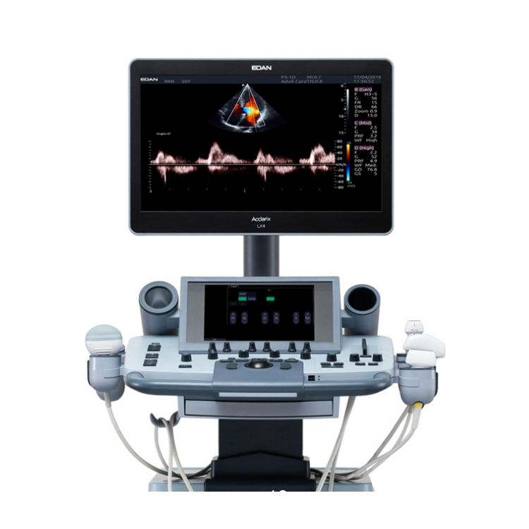彩超推車式全數(shù)字彩色超聲診斷系統(tǒng)Acclarix LX4