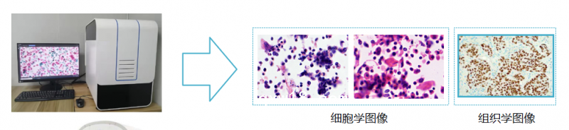 子宮內(nèi)膜癌篩查細(xì)胞醫(yī)學(xué)圖像分析系統(tǒng)