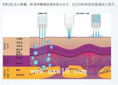 雙頭冷噴治療儀廠家冷熱噴霧機