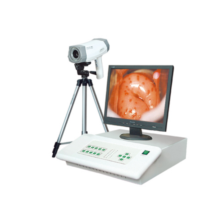 數(shù)碼電子陰道鏡 臺(tái)式陰道鏡BX-8100I、BX-8100II
