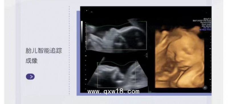 GE彩色超聲診斷儀B超儀器彩超設(shè)備美國通用