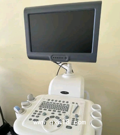 全數(shù)字彩超機B超機