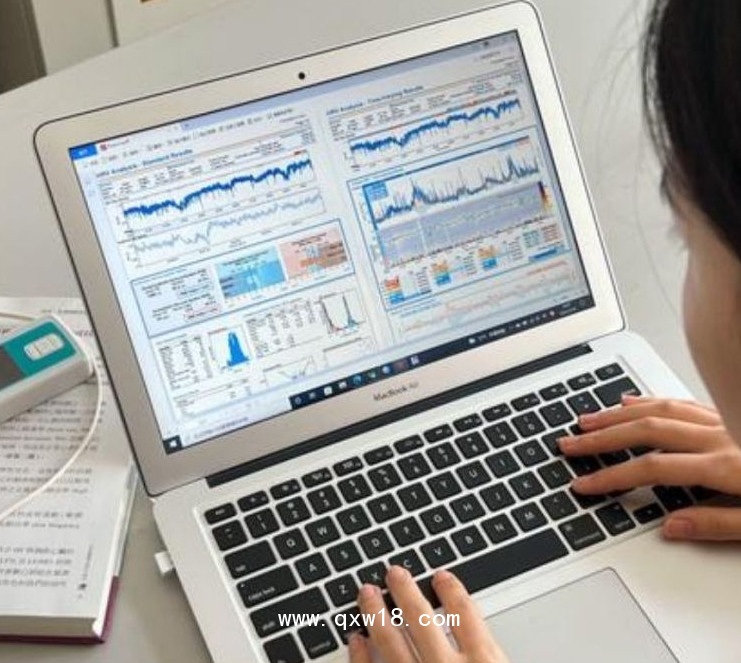 韓邁迪克醫(yī)療 心率變異分析系統(tǒng) SA-3000P 用于對(duì)心率進(jìn)行測(cè)量