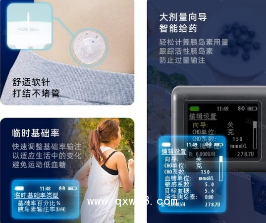 糖脈新款手機連接智能胰島素泵