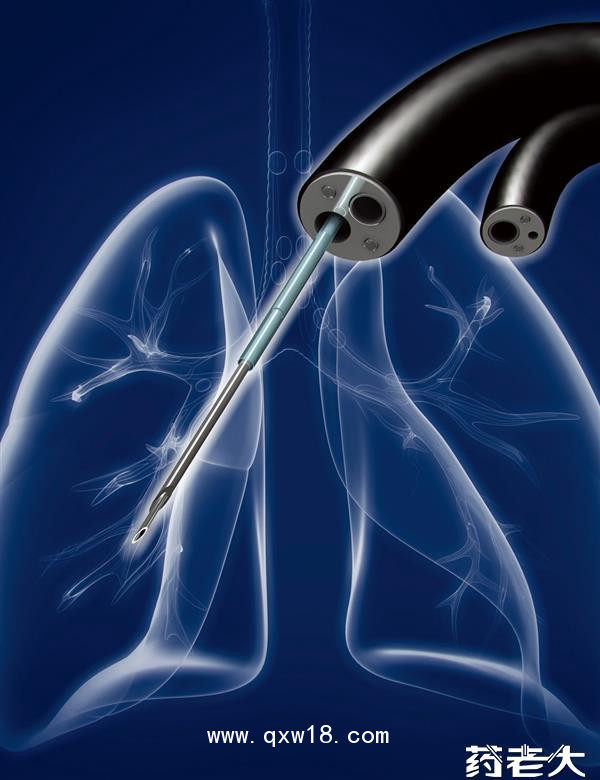 王氏TBNA活檢穿刺針細胞針