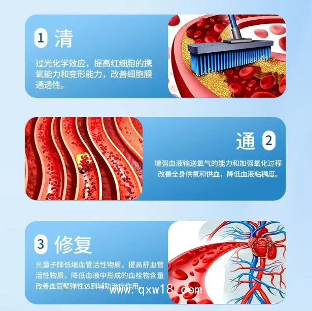 康企頸部半導體激光治療儀（暢享款）三高治療儀心血通心腦血管腦梗塞冠心病三高脂血高血壓