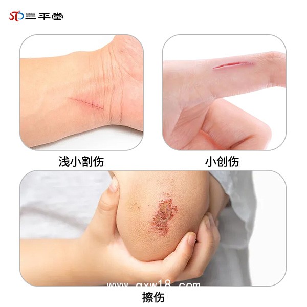 傷口清洗醫(yī)用液體敷料-傷口消毒殺菌-傷口消毒敷料促進(jìn)愈合