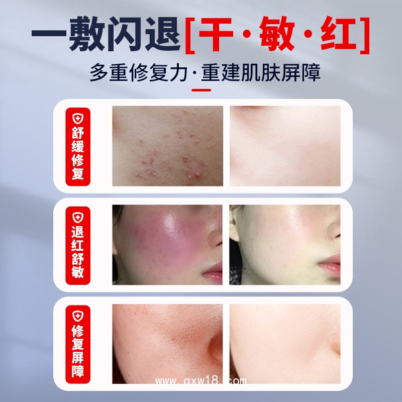 透明質酸鈉敷料 二類械字號 美容院線專供