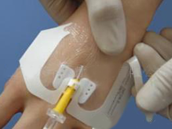 蝶形留置針專用敷貼（U型口敷料）