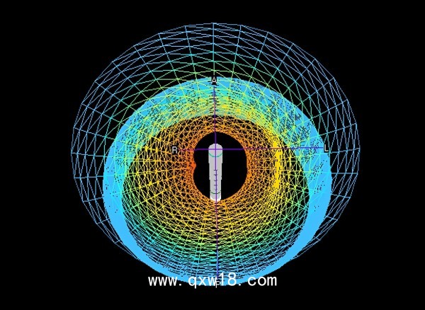 胃腸動(dòng)力診斷系統(tǒng)