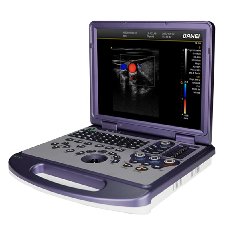 彩超機  便攜式彩超