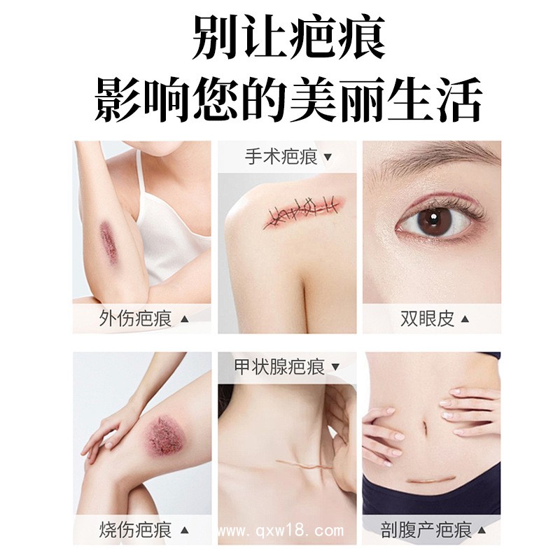 醫(yī)用疤痕貼代加工/可定制不同規(guī)格尺寸械字號/0元拿樣全流程質檢