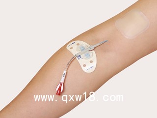 醫(yī)用導(dǎo)管體表固定裝置代加工