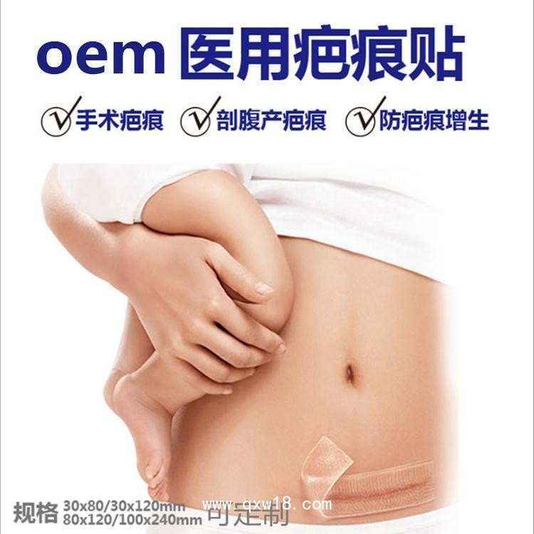 醫(yī)用疤痕貼/醫(yī)用疤痕貼加工/醫(yī)用疤痕貼OEM貼牌