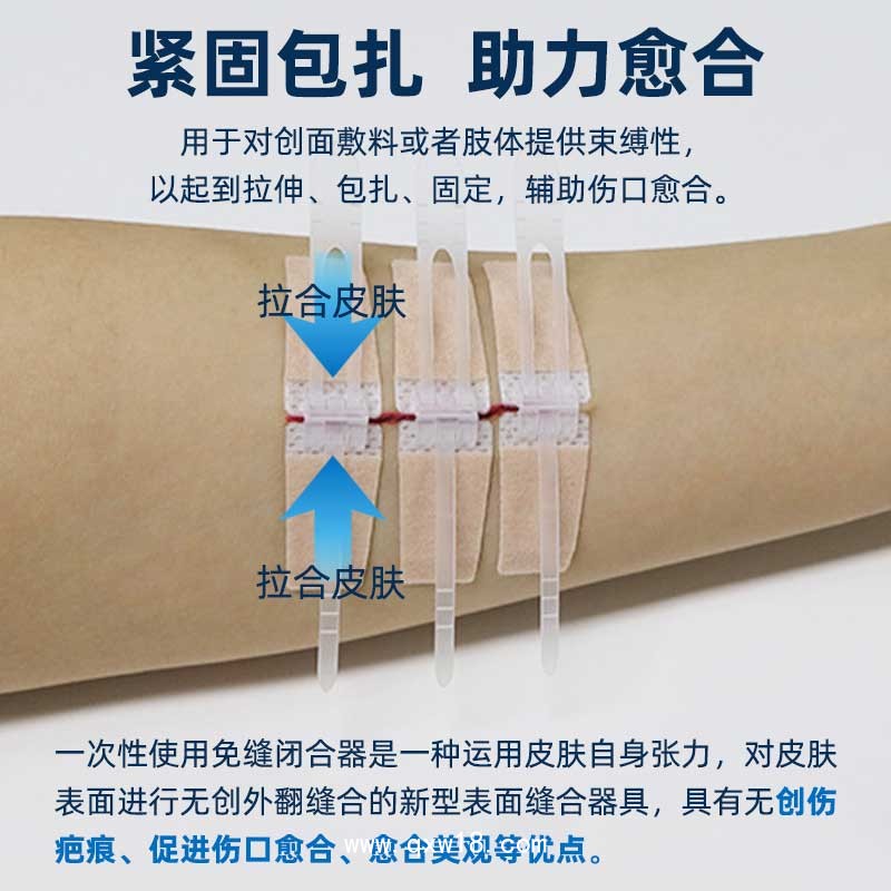 醫(yī)用疤痕減張器 皮膚免縫合oem