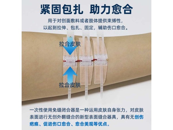 醫(yī)用免縫閉合器 傷口愈合貼 可代工