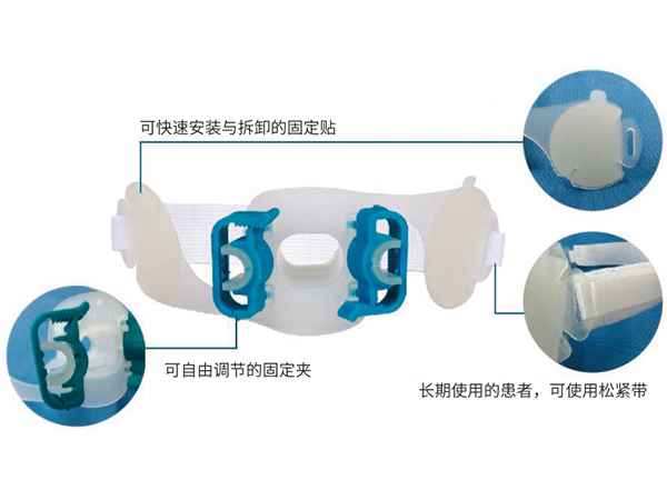 氣管插管固定器