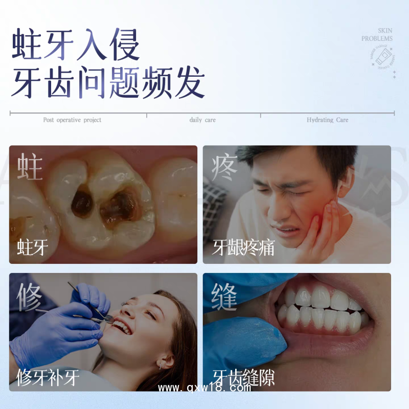 醫(yī)用口腔防蛀膏廠家 現(xiàn)貨批發(fā)二類(lèi)械字號(hào)院線同款可定制益生菌牙膏