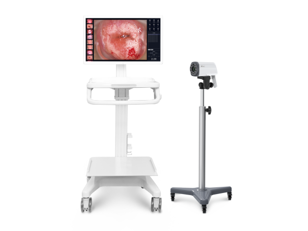 陰道鏡、4K電子陰道鏡C28 UHD PRO MAX