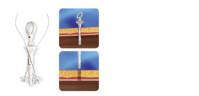 1530687864437778.png blob.png