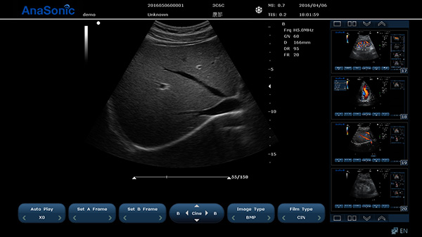 圖片關(guān)鍵詞
