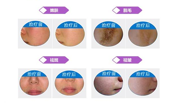 治療對比.jpg