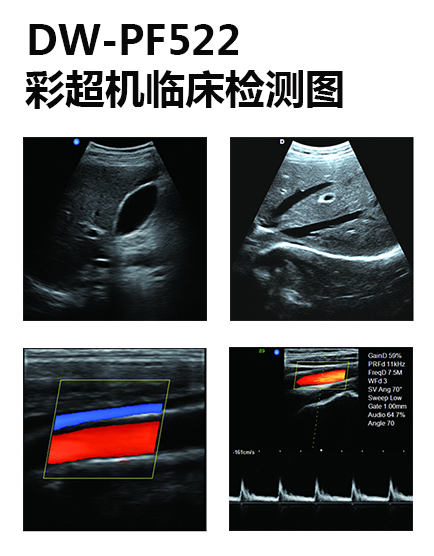 dw-PF522臨床檢測(cè)圖.jpg