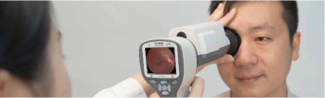 芬蘭歐視博 手持式免散瞳眼底相機(jī) OPTOMED M5.png