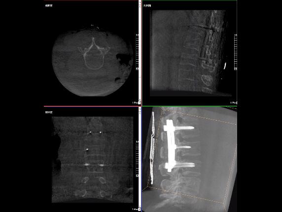 【醫(yī)療科普】2分鐘帶你了解高質(zhì)量X光片的標準是什么？