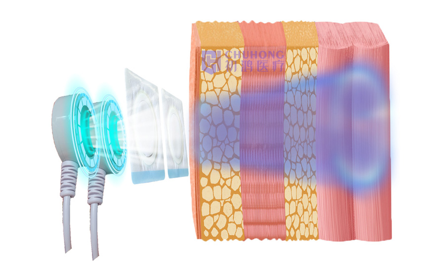 1657627275121700.jpg 1657627275121700.jpg