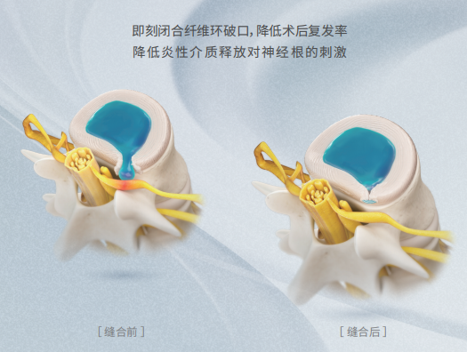 1681449637122876.png 26d7e705ee2631667183aacf613de57.png